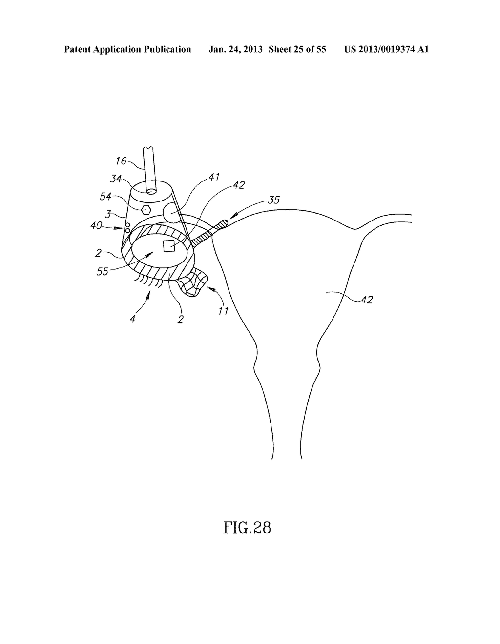 GEL-BASED SEALS AND FIXATION DEVICES AND ASSOCIATED SYSTEMS AND METHODS - diagram, schematic, and image 26