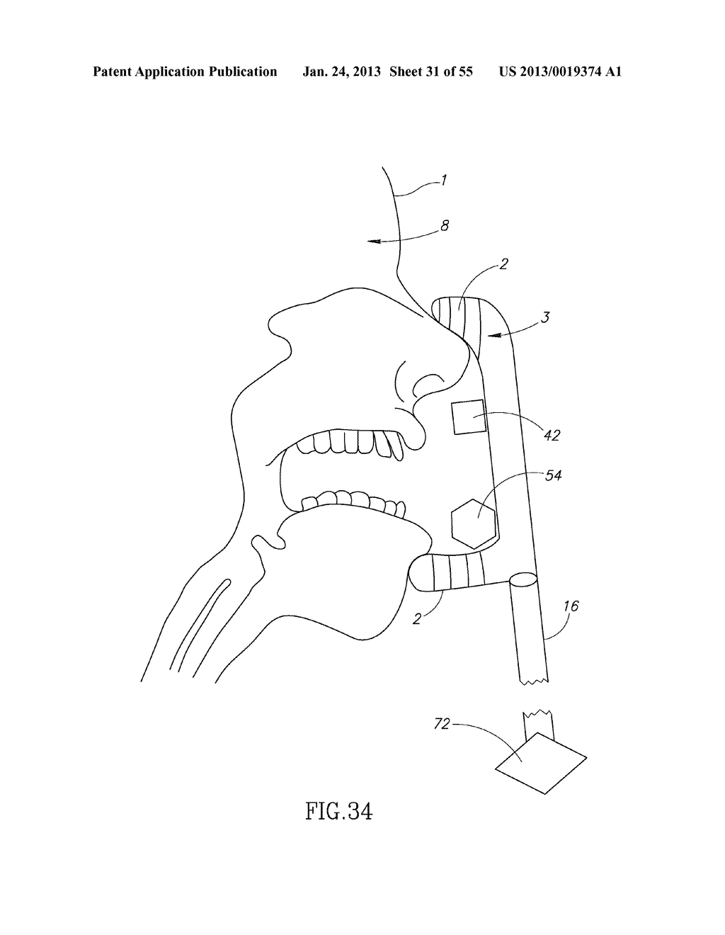 GEL-BASED SEALS AND FIXATION DEVICES AND ASSOCIATED SYSTEMS AND METHODS - diagram, schematic, and image 32