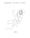 GEL-BASED SEALS AND FIXATION DEVICES AND ASSOCIATED SYSTEMS AND METHODS diagram and image