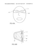 GEL-BASED SEALS AND FIXATION DEVICES AND ASSOCIATED SYSTEMS AND METHODS diagram and image