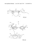 GEL-BASED SEALS AND FIXATION DEVICES AND ASSOCIATED SYSTEMS AND METHODS diagram and image