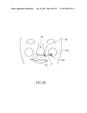 GEL-BASED SEALS AND FIXATION DEVICES AND ASSOCIATED SYSTEMS AND METHODS diagram and image