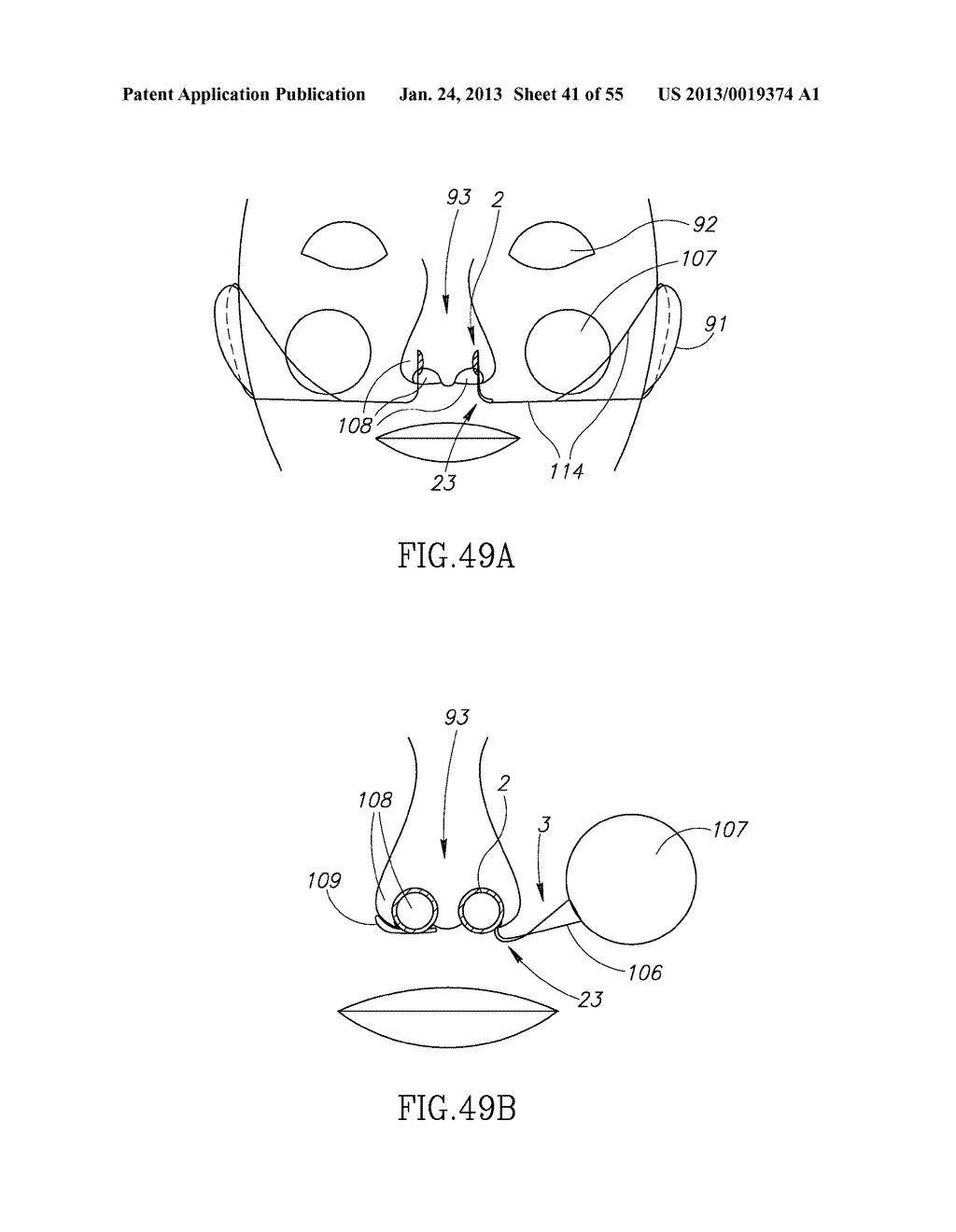 GEL-BASED SEALS AND FIXATION DEVICES AND ASSOCIATED SYSTEMS AND METHODS - diagram, schematic, and image 42