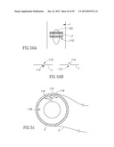 GEL-BASED SEALS AND FIXATION DEVICES AND ASSOCIATED SYSTEMS AND METHODS diagram and image