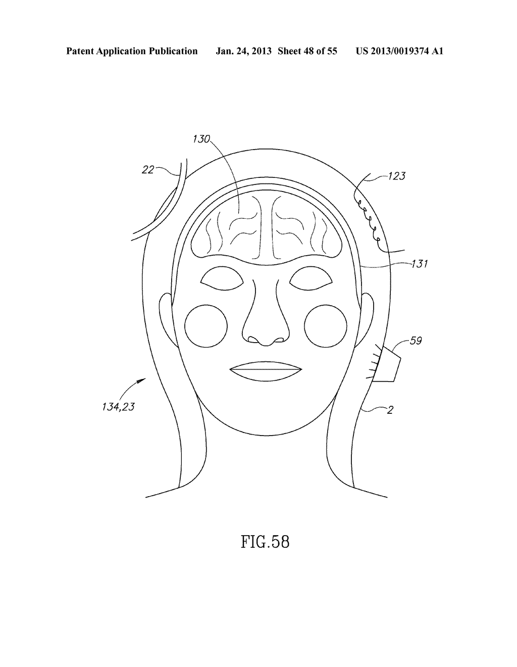 GEL-BASED SEALS AND FIXATION DEVICES AND ASSOCIATED SYSTEMS AND METHODS - diagram, schematic, and image 49