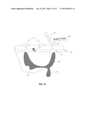 Burrow Filling Compressed Growing Medium diagram and image