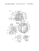 METHODS, SYSTEMS AND DEVICES FOR IMPROVING VENTILATION IN A LUNG AREA diagram and image