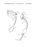 METHODS, SYSTEMS AND DEVICES FOR IMPROVING VENTILATION IN A LUNG AREA diagram and image