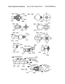 METHODS, SYSTEMS AND DEVICES FOR IMPROVING VENTILATION IN A LUNG AREA diagram and image