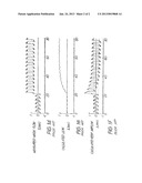 DETERMINATION OF LEAK DURING CPAP TREATMENT diagram and image