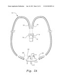 VENTILATION INTERFACE FOR SLEEP APNEA THERAPY diagram and image