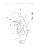 VENTILATION INTERFACE FOR SLEEP APNEA THERAPY diagram and image