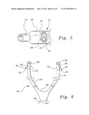 VENTILATION INTERFACE FOR SLEEP APNEA THERAPY diagram and image