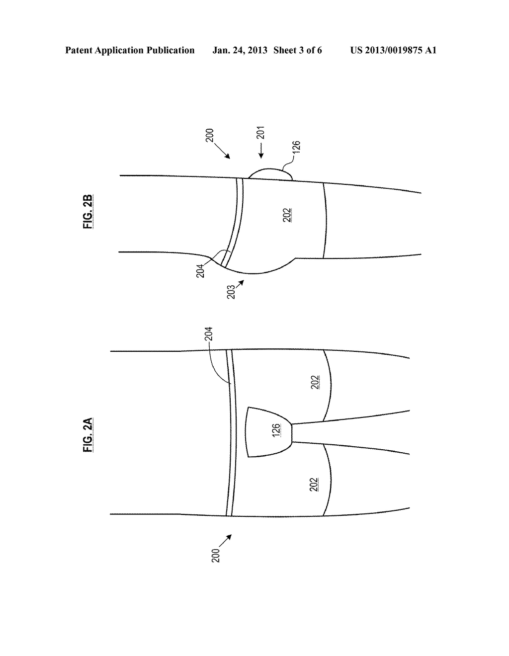 RADIATION TREATMENT GARMENT - II - diagram, schematic, and image 04