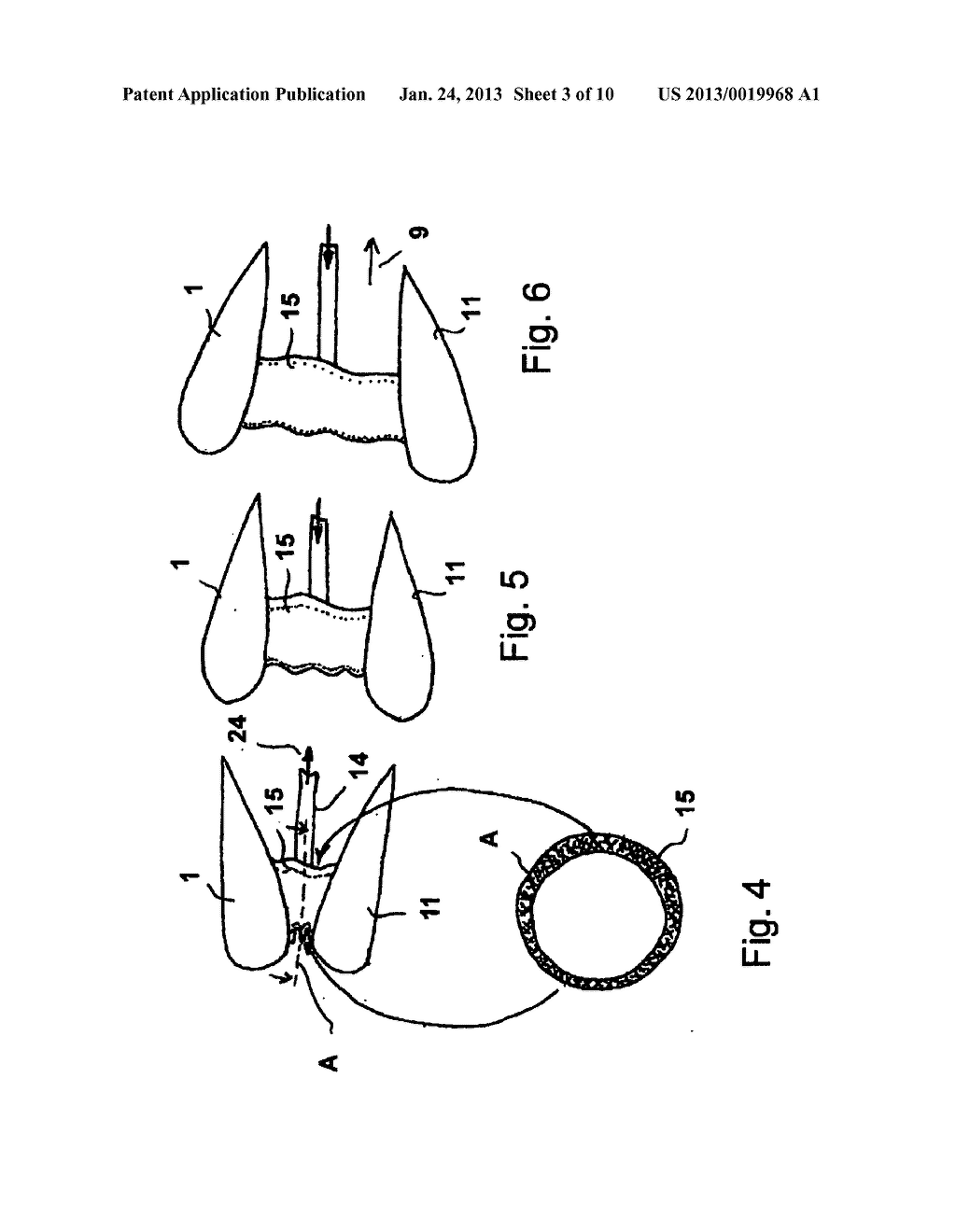 CONVEYING DEVICE FOR A FLUID - diagram, schematic, and image 04