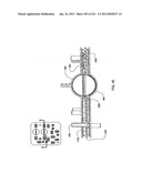 BLOOD TREATMENT SYSTEMS AND METHODS diagram and image