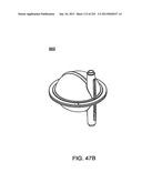 BLOOD TREATMENT SYSTEMS AND METHODS diagram and image