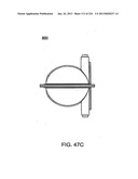 BLOOD TREATMENT SYSTEMS AND METHODS diagram and image