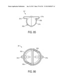 BLOOD TREATMENT SYSTEMS AND METHODS diagram and image