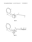 Mobile Electronic Device (MED) Mounting and Positioning Bracket Assembly diagram and image