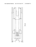 Method for Operating an Electrical Surgical Instrument with Optimal Tissue     Compression diagram and image