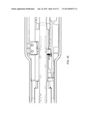 Method for Operating an Electrical Surgical Instrument with Optimal Tissue     Compression diagram and image