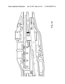 Method for Operating an Electrical Surgical Instrument with Optimal Tissue     Compression diagram and image