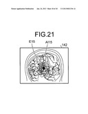 IMAGE PROCESSING SYSTEM, IMAGE PROCESSING DEVICE, IMAGE PROCESSING METHOD,     AND MEDICAL IMAGE DIAGNOSTIC DEVICE diagram and image