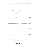 ZOOM LENS diagram and image