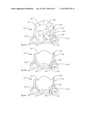 Lens Assembly For Illumination Device diagram and image