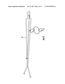 Overhead Conductor Sensor diagram and image