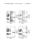 AUTOMATED METHOD OF CLASSIFYING AND SUPPRESSING NOISE IN HEARING DEVICES diagram and image