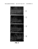 METHOD AND SYSTEM FOR TOOTH SEGMENTATION IN DENTAL IMAGES diagram and image