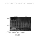 METHOD AND SYSTEM FOR TOOTH SEGMENTATION IN DENTAL IMAGES diagram and image