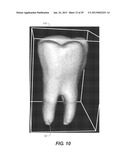 METHOD AND SYSTEM FOR TOOTH SEGMENTATION IN DENTAL IMAGES diagram and image