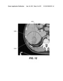 METHOD AND SYSTEM FOR TOOTH SEGMENTATION IN DENTAL IMAGES diagram and image