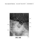 METHOD AND SYSTEM FOR TOOTH SEGMENTATION IN DENTAL IMAGES diagram and image