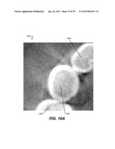 METHOD AND SYSTEM FOR TOOTH SEGMENTATION IN DENTAL IMAGES diagram and image