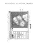 METHOD AND SYSTEM FOR TOOTH SEGMENTATION IN DENTAL IMAGES diagram and image