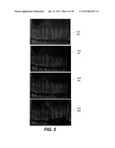 METHOD AND SYSTEM FOR TOOTH SEGMENTATION IN DENTAL IMAGES diagram and image