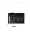 METHOD AND SYSTEM FOR TOOTH SEGMENTATION IN DENTAL IMAGES diagram and image