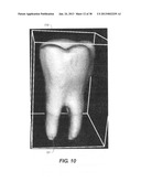 METHOD AND SYSTEM FOR TOOTH SEGMENTATION IN DENTAL IMAGES diagram and image