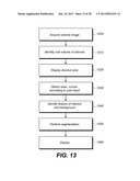 METHOD AND SYSTEM FOR TOOTH SEGMENTATION IN DENTAL IMAGES diagram and image