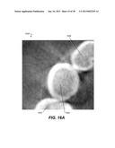 METHOD AND SYSTEM FOR TOOTH SEGMENTATION IN DENTAL IMAGES diagram and image