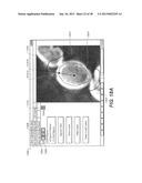 METHOD AND SYSTEM FOR TOOTH SEGMENTATION IN DENTAL IMAGES diagram and image