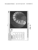 METHOD AND SYSTEM FOR TOOTH SEGMENTATION IN DENTAL IMAGES diagram and image