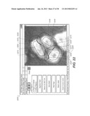 METHOD AND SYSTEM FOR TOOTH SEGMENTATION IN DENTAL IMAGES diagram and image