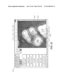 METHOD AND SYSTEM FOR TOOTH SEGMENTATION IN DENTAL IMAGES diagram and image