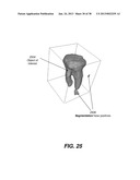 METHOD AND SYSTEM FOR TOOTH SEGMENTATION IN DENTAL IMAGES diagram and image