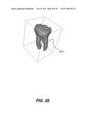 METHOD AND SYSTEM FOR TOOTH SEGMENTATION IN DENTAL IMAGES diagram and image